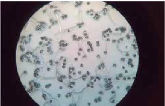 Figura 4. Visualización de granos de polen E. guineensis, con el uso  del microscopio (campo de visión 10x), trascurridas dos horas desde  la siembra.