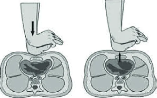 Figura 8 – O que acontece dentro do peito, quando afundamos ele. Ilus- Ilus-tração: Serious Game “HANDS 2 HELPS” - Produto desenvolvido por Ruy 
