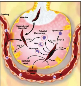 Figure 1 - An injured alveolus with protein-rich oedema fluid and an in- in-flux of inflammatory cells, secondary to endothelial as well as epithelial  injury, showing the potential for MSCs to be delivered via the air spaces  or circulation