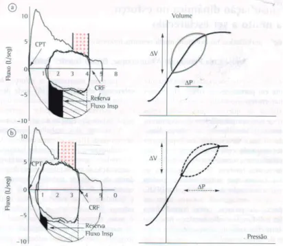 Figura 1 – A) Paciente com DPOC com baixa demanda ventilatória. B)  Paciente com DPOC em alta demanda ventilatória com deslocamento da  capacidade residual funcional (CRF) em direção a capacidade pulmonar  total (CPT), aonde um maior gradiente de pressão g