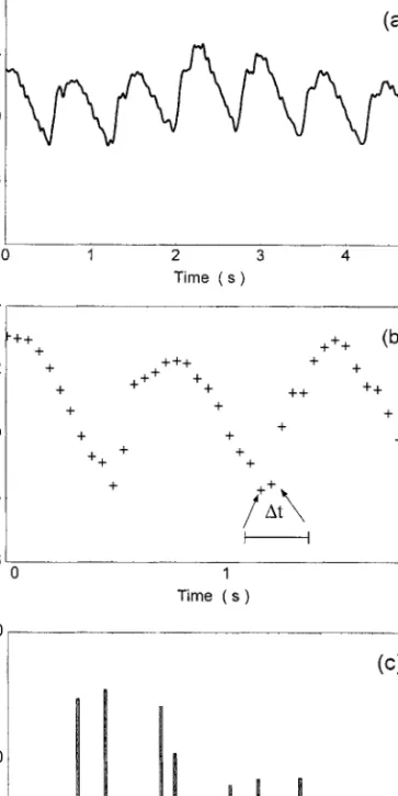 FIGURE 83.1 Examples of continuous and discrete-time signals. (a) Continuous recording of intracranial pressure in a head-injured patient