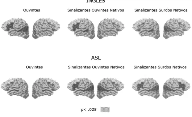 Figura  baseada  na  Figura  4.  Representação  do  cérebro  com  ativação  medida  por  fMRI  em  resposta  a  visualização  da  ASL  ou  leitura  do  inglês  em  três  grupos  diferentes  (ouvintes  não  sinalizantes;  ouvintes  sinalizantes  nativos  e 