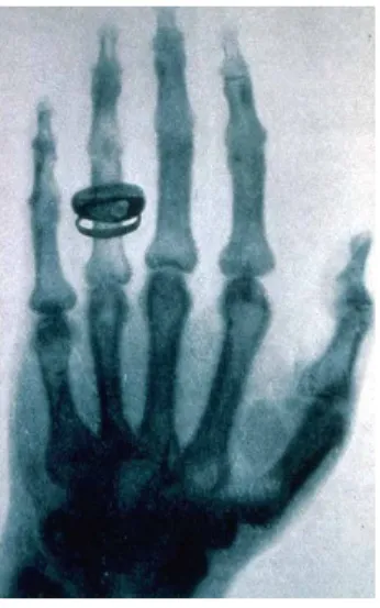 Figura 1: Uma imagem de raios X, feita em 1896 por R¨ ontgen, da m˜ ao esquerda de sua esposa