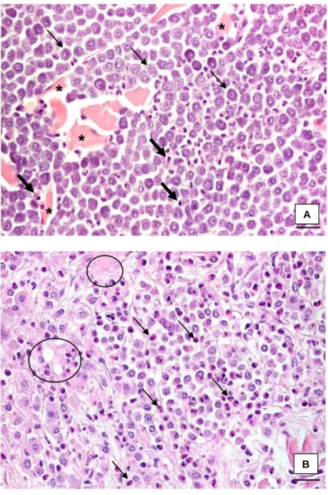 Figura  6  –  Fotomicrografia  de  corte  histológico  de  mastocitoma  cutâneo  canino  de  grau  I  (método  Patnaik)  com  células  tumorais  monomórficas,  bem  diferenciadas  (setas  finas)