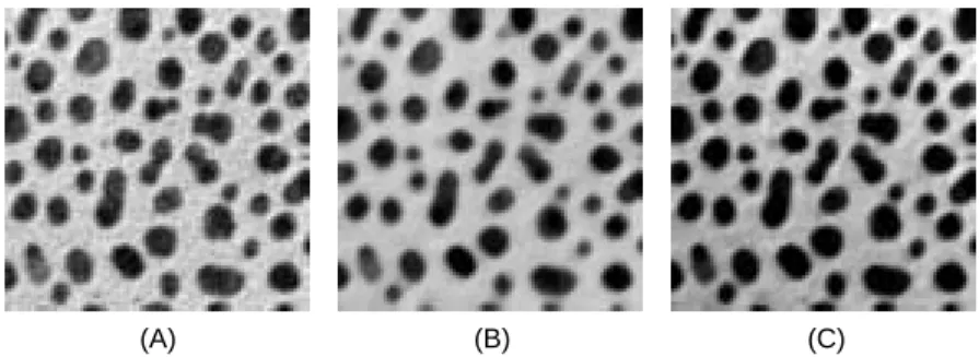 Figura 4: Exemplo de um pre-processamento simples: (A) Imagem original cor- cor-rompida com ru´ıdo gaussiano, (B) Imagem ap´ os a aplica¸ c˜ ao de um ﬁltro mediana para redu¸ c˜ ao do ru´ıdo, e (C) Imagem ﬁnal, ap´ os a aplica¸ c˜ ao de um ﬁltro passa-alta