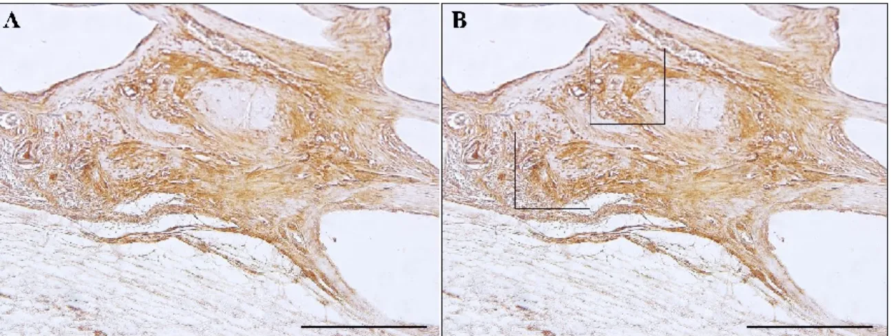 Figura 9 - Esquema de marcação para histomorfometria com OPN 