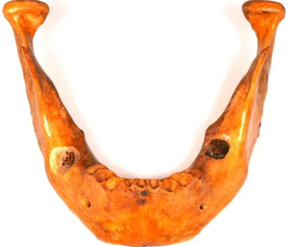Figura 1 – Imagem inicial da mandíbula 