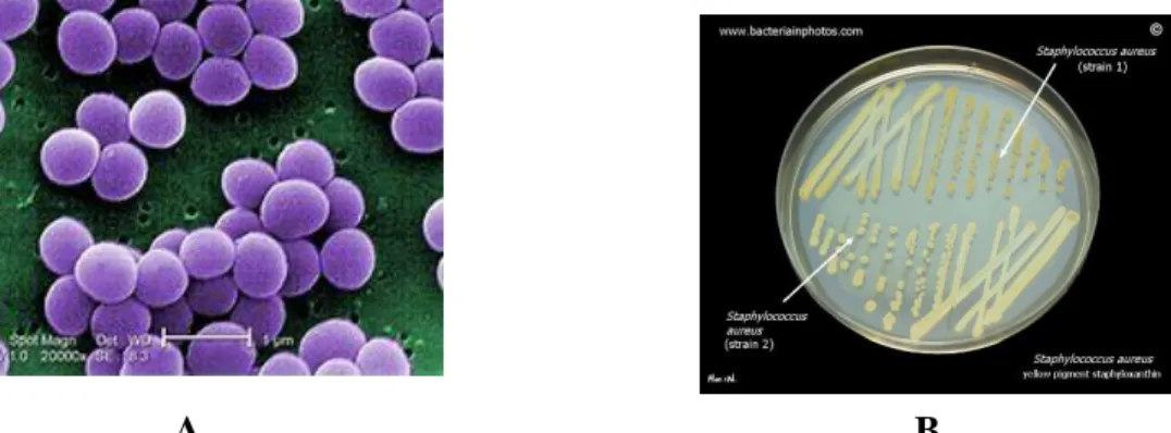 Figura 9:  Staphylococcus aureus - A) Imagem de microscopia eletrônica e B) Colônias  Fonte: http://www.bacteriainphotos.com/ 