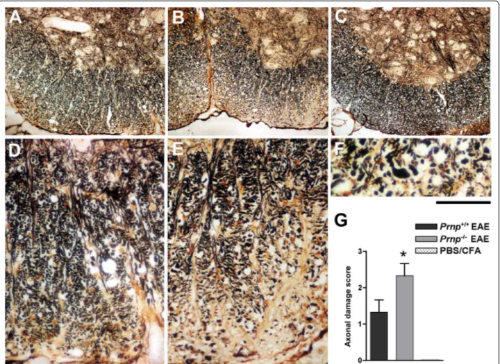 Figure 3 More severe axonal loss/damage in the white matter of Prnp -/- mice. Sections of ventral spinal cord revealed by Bielschowsky’s silver staining; (A) Prnp +/+ EAE-induced mouse; (B) Prnp -/- EAE-induced mouse and (C) non-EAE PBS/CFA control