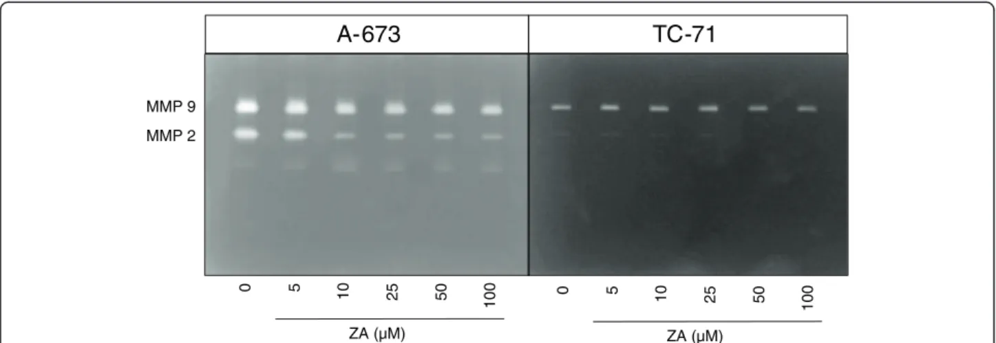 Figure 2 Effect of zoledronic acid (ZA) on MMP activity analyzed by gelatin zymography