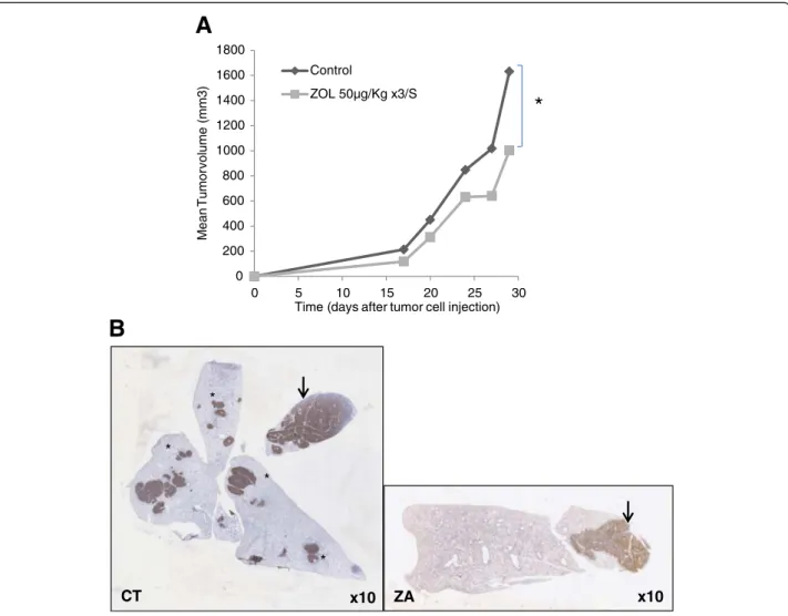 Figure 3 Effect of ZA on tumor progression and metastasis dissemination. A. Comparison of tumor volume evolution between ZA (50 μg/kg, 3 times a week during 4 weeks) treated and non treated (PBS) nude mice in the A-673 Ewing ’ s sarcoma model; B: Histologi