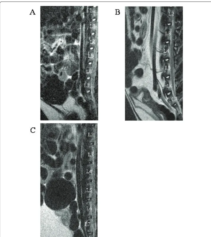 Figure 1 MRI images of the lumbar spine of rabbits with increasing ages. T2-weighted midsagittal images of (A) one-, (B) six- and (C) 30- 30-month-old rabbits