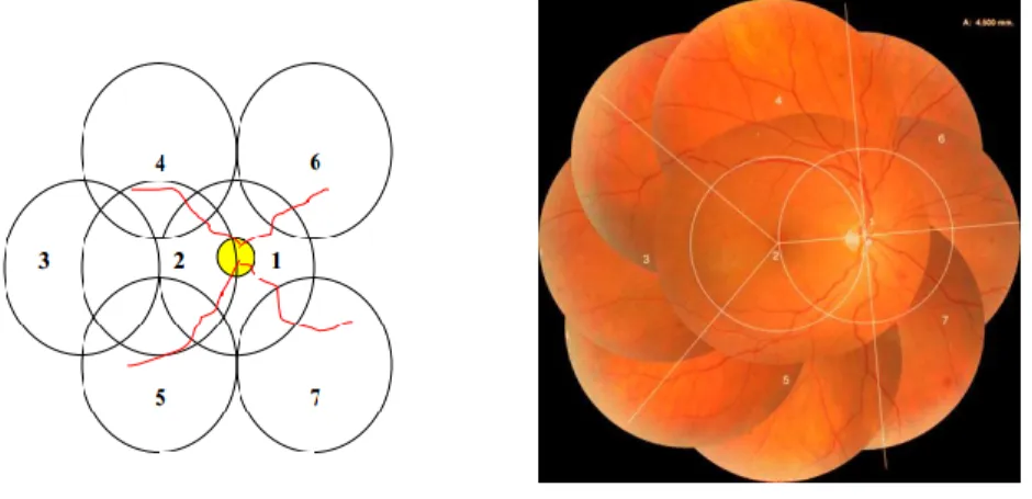 Figure 6- La démonstration des 7 champs sur le fond d'œil droit   