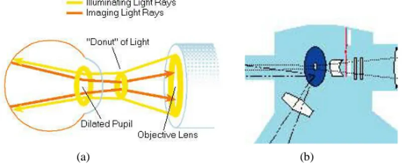 Figure 9- L’illumination du fond de l’œil par la caméra (a), le miroir en disque (b)   http://www.opsweb.org/?page=fundusphotography  