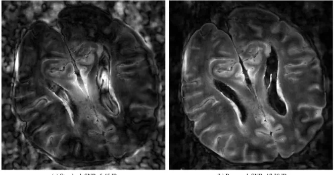 Figure 11: Nonlinear, total variation based reconstructions of ex vivo humain brain with a Sparkling trajectory, without (a) and with (b) the bandlimiting filtering accounted for