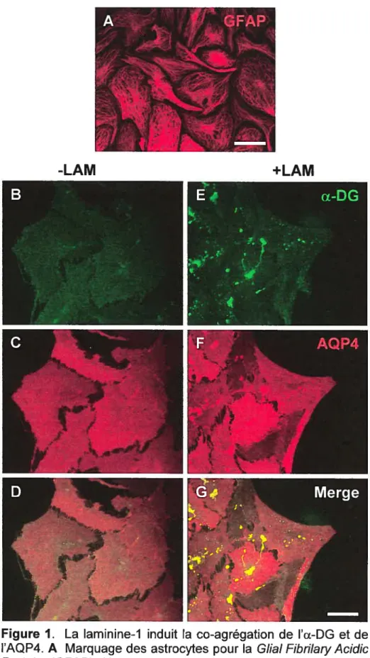 Figure 1. La laminine-1 induit la co-agrégation de l’a-DG et de l’AQP4. A Marquage des astrocytes pour la Guai Fibrilary Acidic Protein (GFAP)