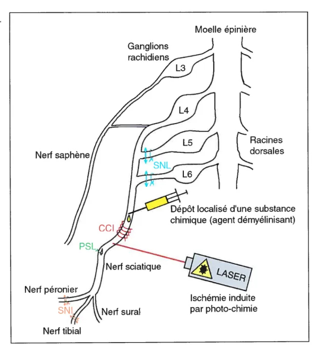 Figure 9: Schéma représentant les principaux modèles animaux de douleur neuropathique sur le nerf sciatique par lésion mécanique: CCI (chronic constriction injwy), PSL (partial sciatic nerve Ïigation), SNL (sciatic nerve ligation), SNI (spared nerve injuiy