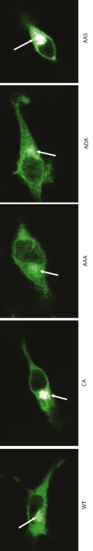 Figure 11 : Localisation des constructions de la ligase Itch dans des cellules COS. La forme normale (WT) et les mutants CA, AAA, ADA et AAS de la ligase Itch sont surexprimés dans des cellules COS par une transfection à la lipofectamine (Lipofectamine 200