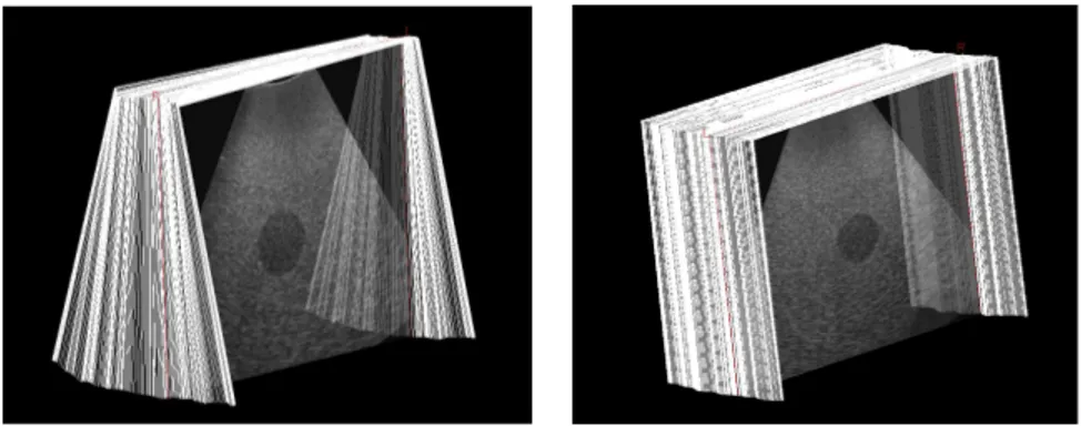 Fig. 6.4 – B-scans sequences used during evaluation. Left : fan sequence. Right : trans- trans-lation sequence.