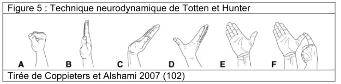 Figure 5 : Technique neurodynamique de Totten et Hunter 