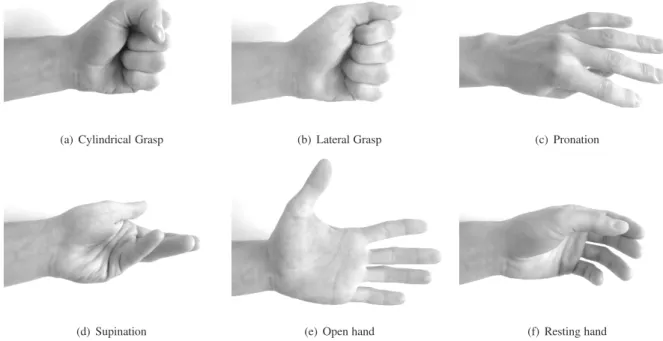 Figure 1: Five hand gestures plus resting position used in this study.