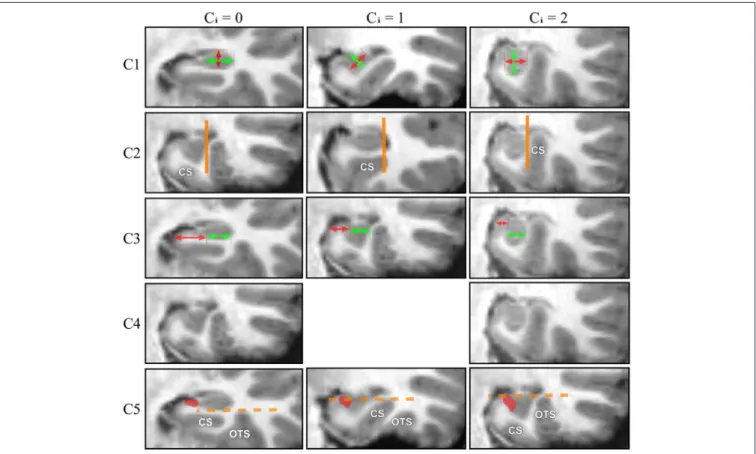 FIGURE 2 | For each IHI criterion, examples corresponding to 3 different grades (0, 1, 2) are displayed.