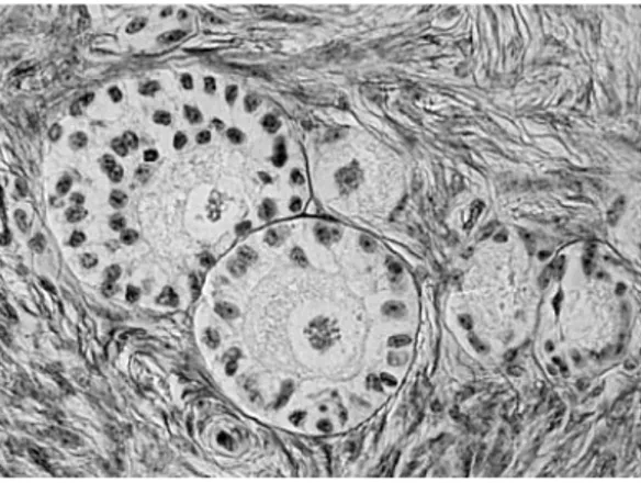 Fig. I.5 Histological slice of an ovary with different types of follicles.