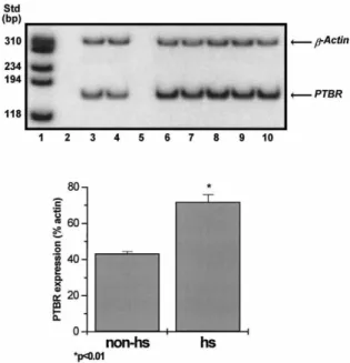 Figure 3. Upper panel: Expression of the PTBR mRNA in TLE patients. 