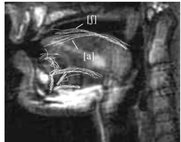 Figure 8. Vocal tract area function during the  transition from / ʃ / (bold line) to /a/