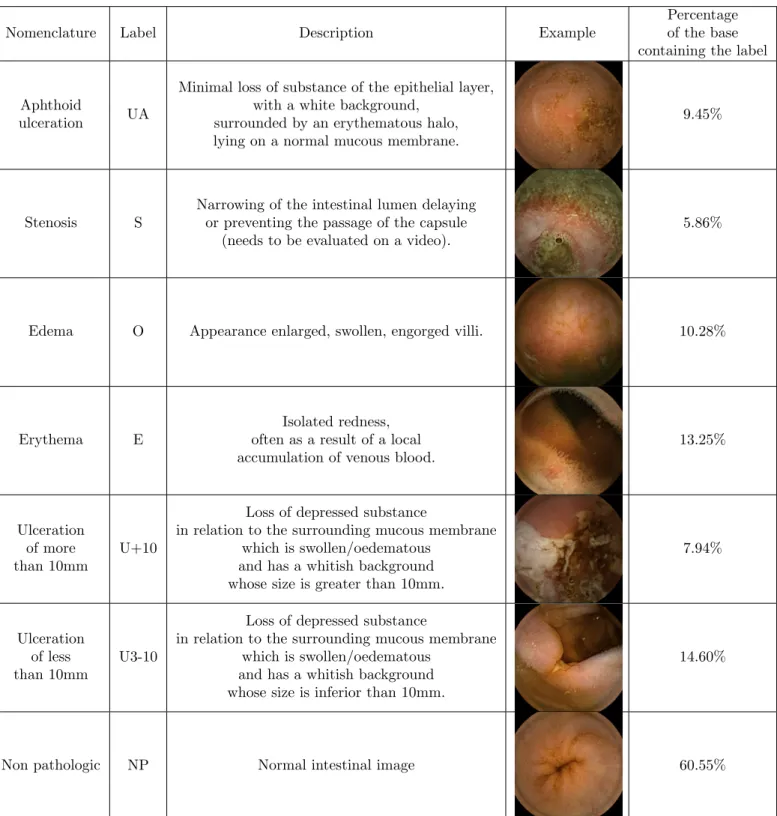 Table 2. Label description and distribution in the database. 14% of the images have multiple labels (1.2 labels/image in average).
