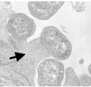 Figure  4.  Lésion  A/E.  Selon  Carvalho  et  al.  [57].  Lésion  A/E  telle  qu’indiquée  par une flèche et formée par la souche EHEC 86-24 de sérotype O157:H7 sur les  cellules HCT-8 (cellule épithéliale du colon humain)