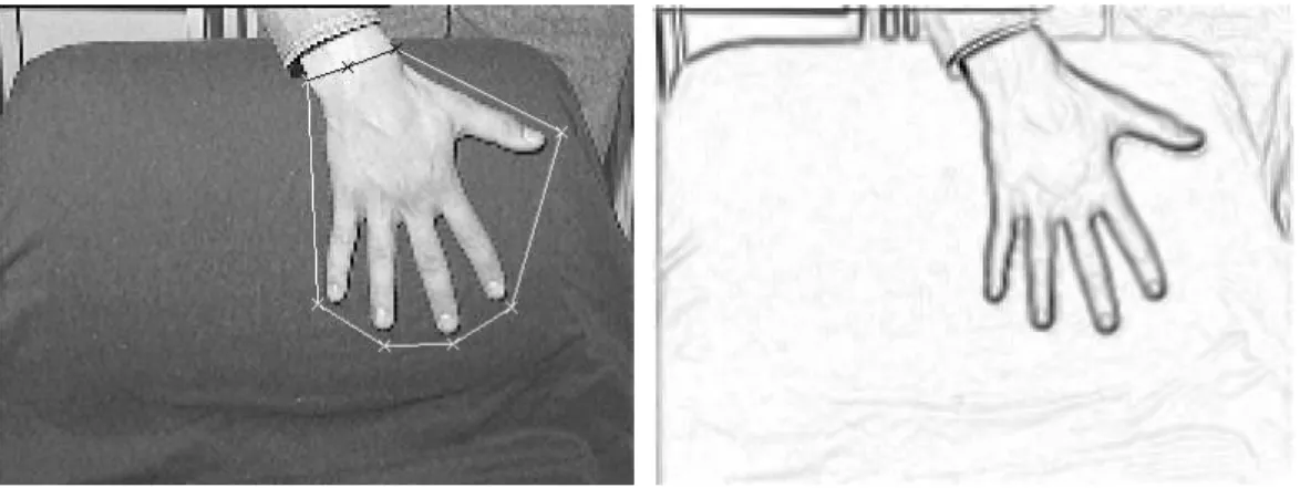 Figure 10 – Figure de gauche: Image et initialisation du contour ge´ode´sique (partie fixe en noir), figure de droite: gradient de l’image
