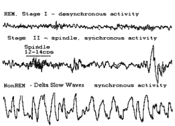 Figure 4.  EEG Patterns associated with the stages of sleep in humans.  [Adapted  from Hauri, P  &amp;  Orr, W