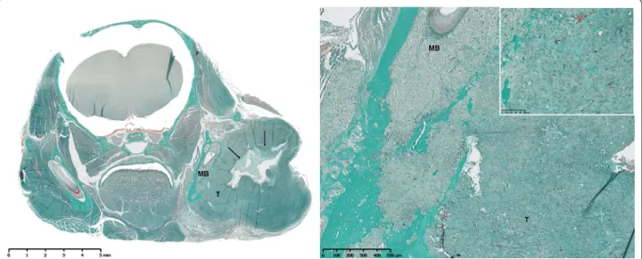 Fig. 1  Masson’s trichrome staining of a section of a mandibular osteosarcoma developed in an NMRI‑nude mouse (HOS1544 model) in a frontal  view (left, original magnification (OM))