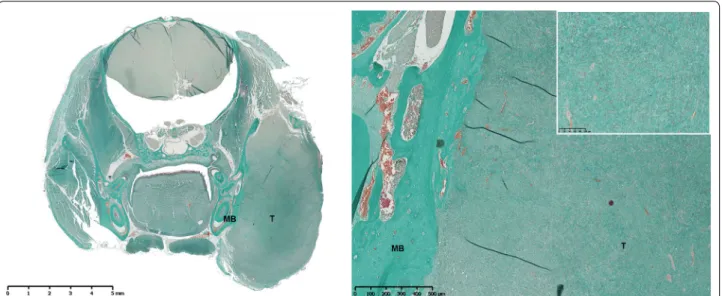 Fig. 2  Masson’s trichrome staining of a section of a mandibular osteosarcoma developed in C57Bl/6 mouse (MOS‑J model) in a frontal view (left,  original magnification (OM))