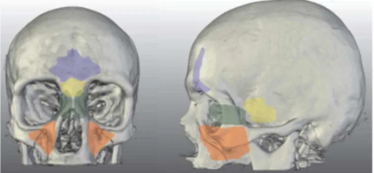 Figure 2.2 – Exemple de visualisation en médecine montrant les cavités sinusales [47].