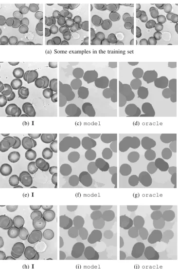 Fig. 4. Results on some examples of cells, for a Mumford-Shah score with a scale parameter s = 1.168