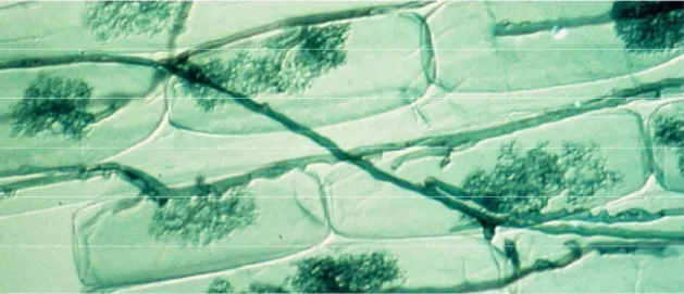 Figure 3 : Endomycorhizes VA, avec des arbuscules se développant à l’intérieur des cellules et reliés par  des hyphes  (Larry Peterson, CNRS) 