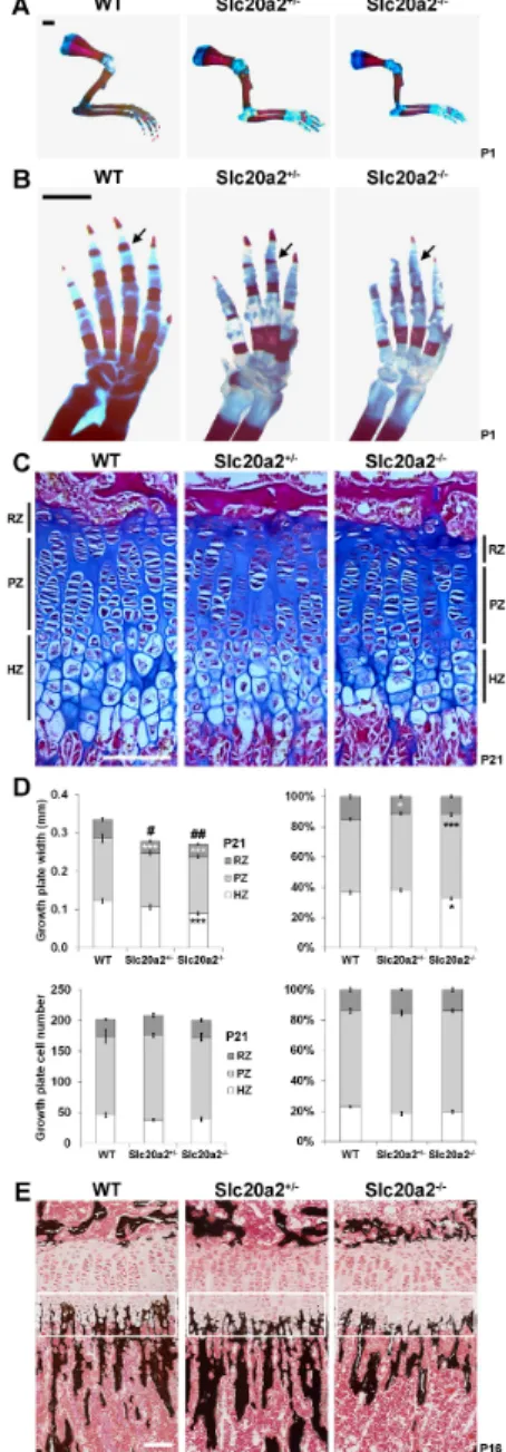 Fig. 4 Decreased bone quality and micromineralization density in Slc20a2 –/– mice. (A) Quantitative X-ray microradiography images of femurs from P112 WT, Slc20a2 +/– , and Slc20a2 –/– female mice