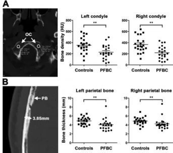 Fig. 7. Primary chondrocyte and osteoblast cultures. (A) Sodium- Sodium-dependent phosphate uptake in primary rib chondrocytes (left) or calvarial osteoblasts (right) from WT and Slc20a2 –/– mice (mean  SE, n ¼ 4 to 7 per genotype, p < 0.01; versus WT; 
