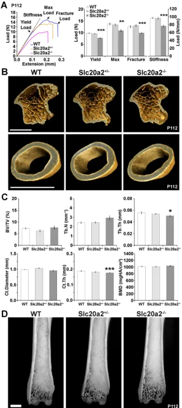 Fig. 3. Decreased bone strength and stiffness in Slc20a2 –/– mice. (A) Representative load displacement curves from three-point bend testing of humeri from P112 WT, Slc20a2 +/– , and Slc20a2 –/– female mice showing yield load, maximum load, fracture load, 