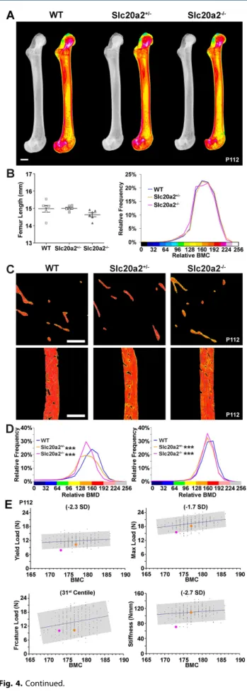 Fig. S5A). However, mCT structural analysis only revealed decreases in some cortical and trabecular bone parameters in adult Slc20a2 –/– mice (Fig