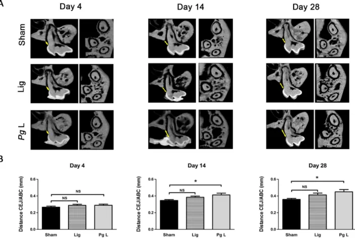 Fig 4. Time-course of alveolar bone loss in the ligature-induced murine model of experimental periodontitis