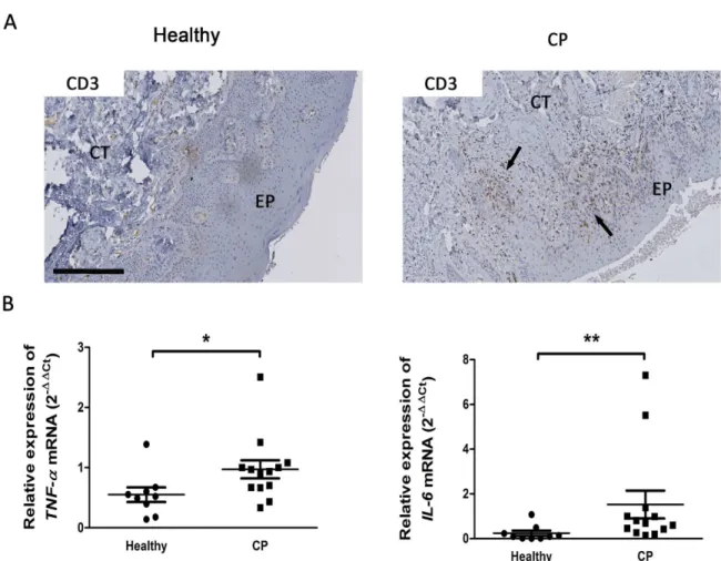 Fig 2. Characterization of human gingival samples in healthy and patients affected by chronic periodontitis