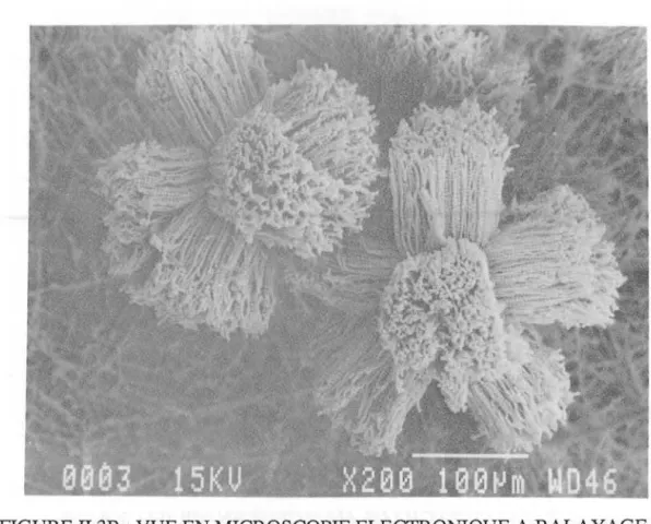 FIGURE II.3B  : VUE EN MICROSCOPIE ELECTRONIQUE A BALAYAGE D'UNE  TETE CONIDIENNE RADIEE DE LA MEME SOUCHE