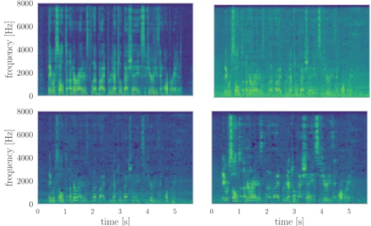 Fig. 4: Log-magnitude spectrograms of clean speech (top- (top-left), corrupted speech (top-right), speech estimated with the Gaussian VAE-MNMF (bottom-left) and speech estimated with the Cauchy VAE-MNMF (bottom-right)