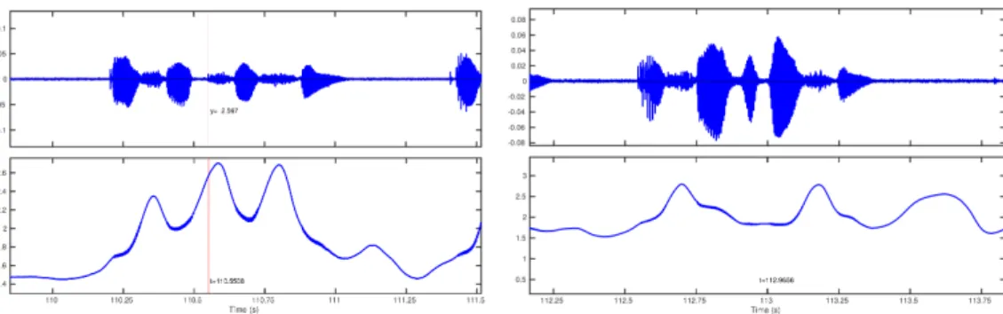 Figure 5. EPGG signal for /asa kKa sa/ and /asa gKa sa/