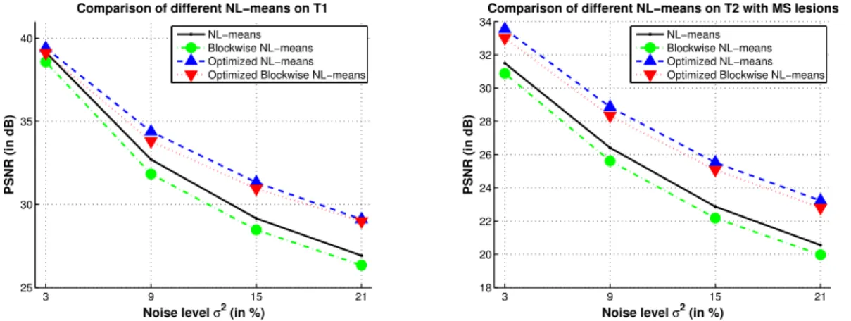 Fig. 9. Impact of the blockwise implementation and voxels selection. Comparison of the different implementations of the NL-means filter, with α = 1.