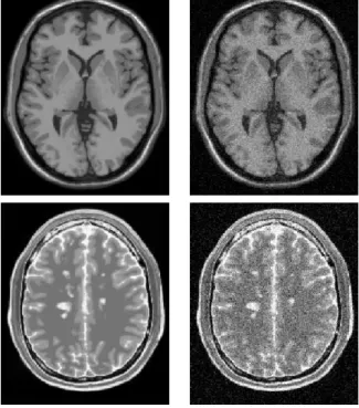 Fig. 5. Synthetic data used for validation with Rician noise. Example of the Brainweb Database