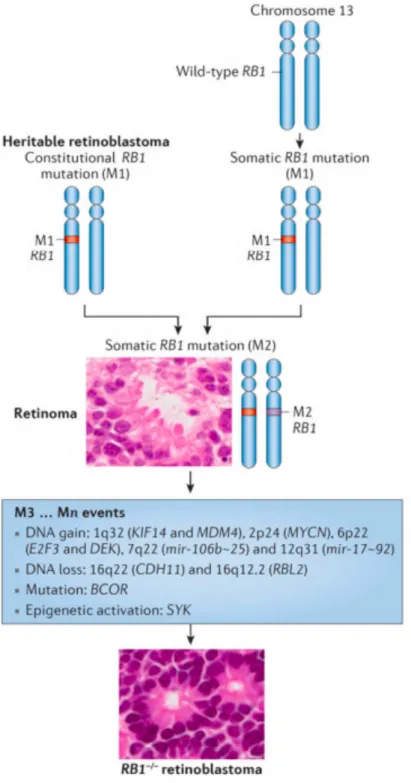 Figure 2. –   Genetic causes of RB1-associated retinoblastoma. Adapted from (20) 